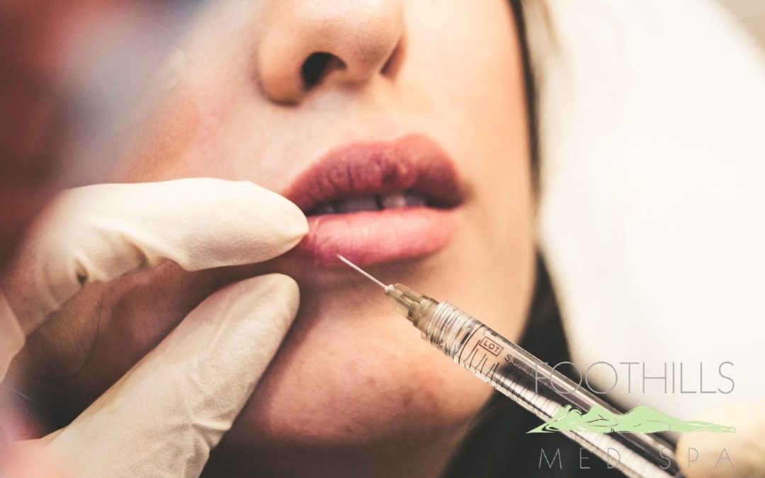 A person getting a syringe injected into their lips