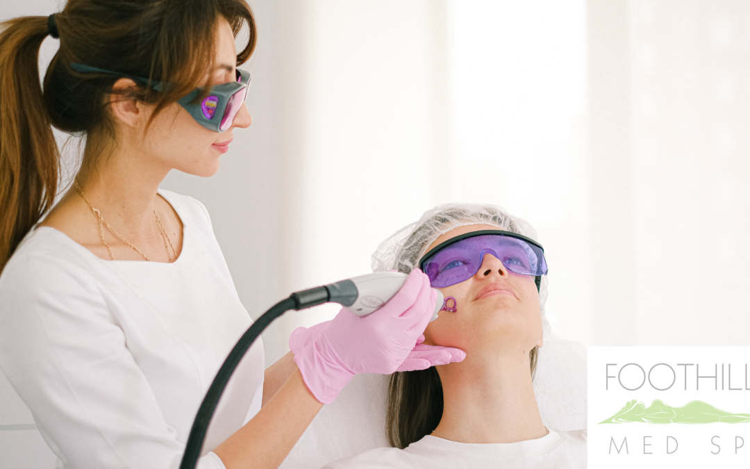 Woman in purple glasses getting a laser hair reduction procedure on her face.
