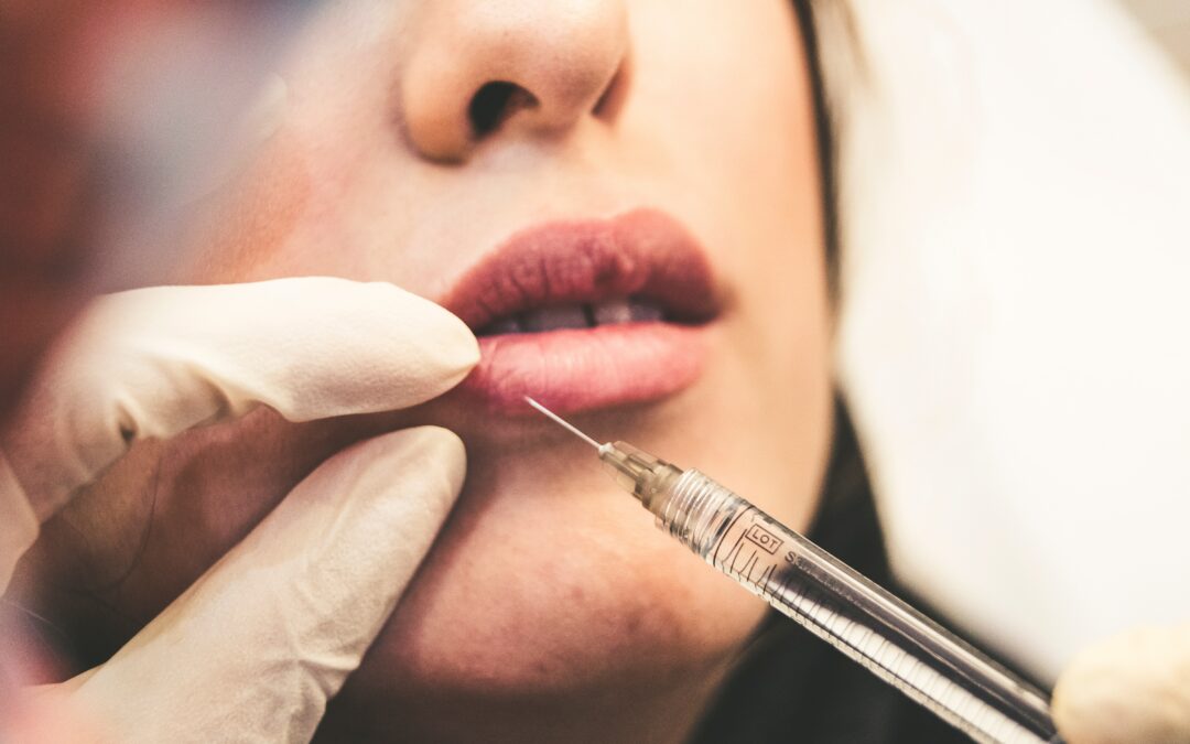 What You Need to Know If You Decide to Get Lip Fillers
